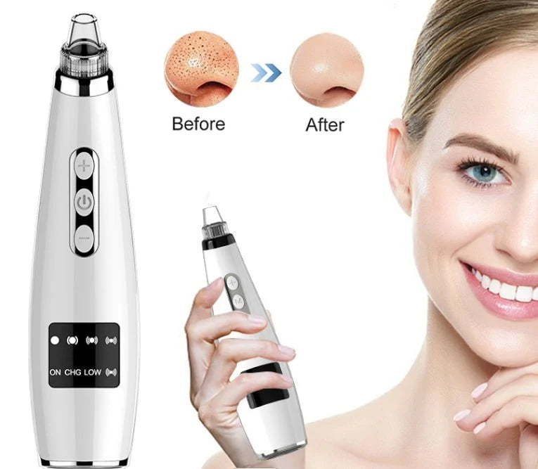 Electric blackhead remover
